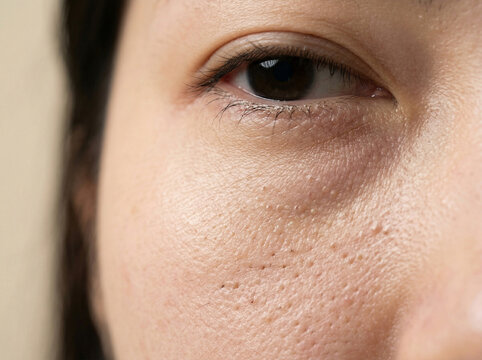 피부 비포 애프터 AI 피부개선 Skin Before After AI Skin Improvement