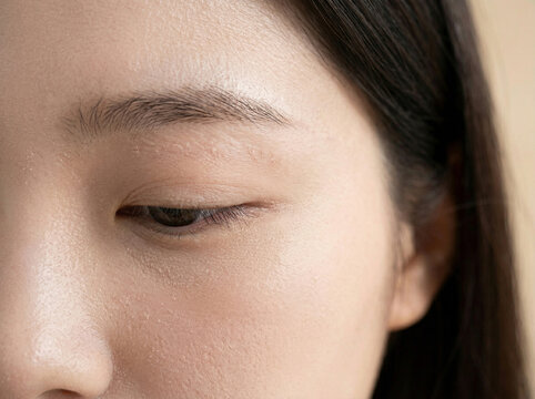 피부 비포 애프터 AI 피부개선 Skin Before After AI Skin Improvement