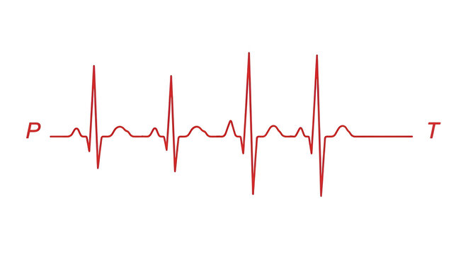 Electrocardiogram showing a heartbeat cycle with p wave, qrs complex, and t wave