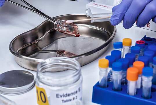 Police expert gets blood sample from a broken glass bottle in Criminalistic Lab, conceptual image