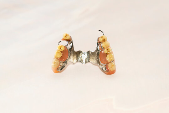 Partial removable dental denture with metal frame and artificial teeth isolated on white background. Macro studio shot. Dental prosthetics and oral healthcare concept.