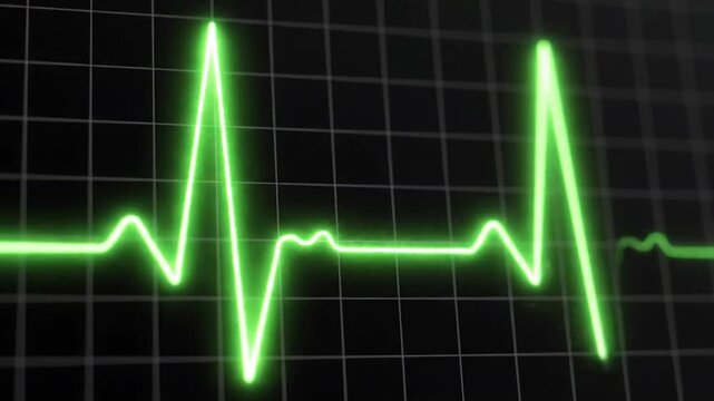Green ecg heartbeat on a black background with a grid pattern