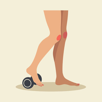 A medical-style illustration in profile. A female foot presses onto a small black fascia roller, showing red discomfort spots on both knees, with copy space.