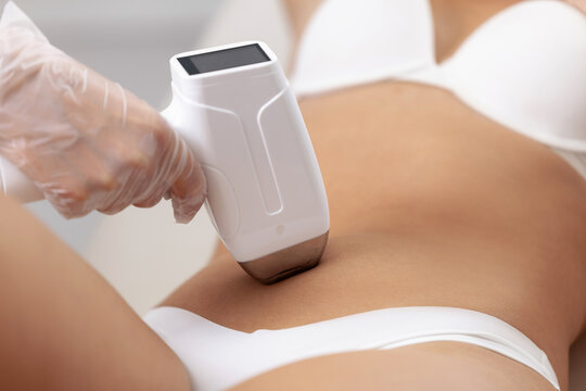 Female laser hair removal procedure on abdomen in beauty clinic