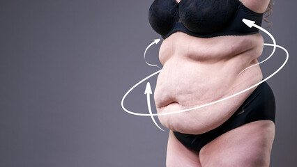 Tummy tuck and weight loss concept. Overweight woman in pinching belly fat with body contouring arrows © staras