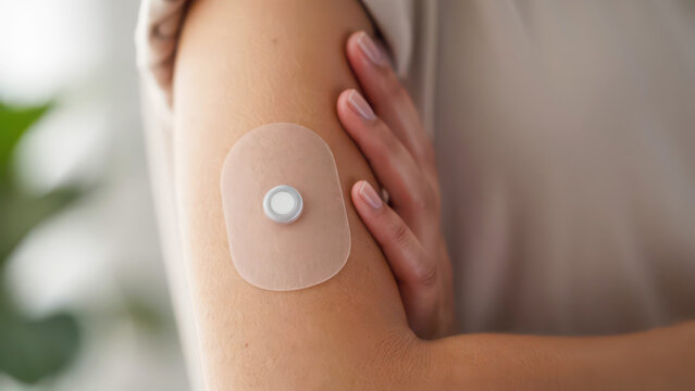 Close up of a modern fertility tracker patch on a woman's arm, representing digital health monitoring, ovulation tracking, and innovative wearable technology for reproductive wellness family planning