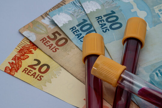 Close up of medical blood samples in test tubes lying on Brazilian Real currency bills symbolizing medical expenses