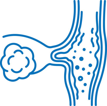 Blue outline of human ear, throat, and nasal passages, medical illustration of upper respiratory system