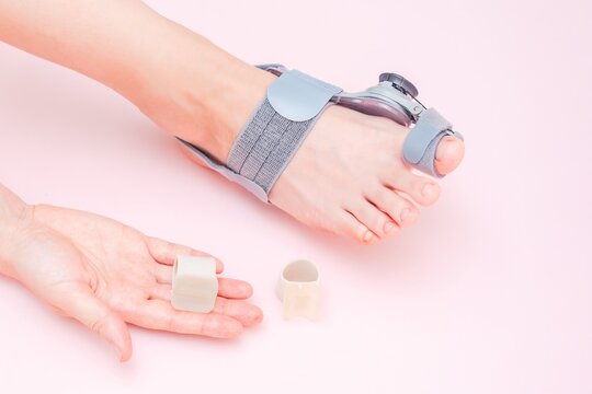 Medical orthopedic bandage and silicone finger separator to treat and prevent Hallux Valgus with adjustment on female foot