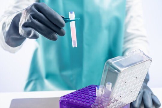 Cryopreservation. Biobanking technician in protective gear working with biological samples