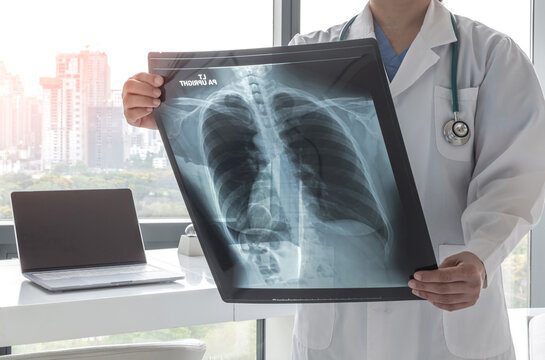 Doctor diagnosing patient&rsquo;s health on asthma, lung disease, COVID-19 or bone cancer illness with radiological chest x-ray film for medical healthcare hospital service