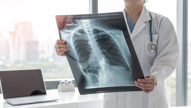 Doctor diagnosing patient&rsquo;s health on asthma, lung disease, COVID-19 or bone cancer illness with radiological chest x-ray film for medical healthcare hospital service