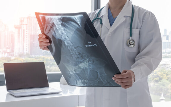 Stomach x-ray film image with doctor for medical and radiological diagnosis on female patient&rsquo;s health on abdominal disease and bone cancer illness, healthcare hospital service concept