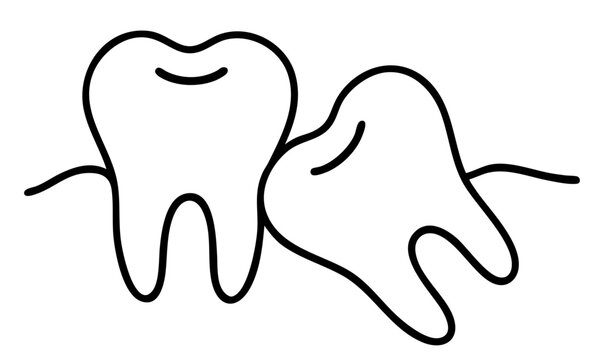 Impacted tilted tooth pressing on adjacent tooth roots, wisdom tooth misalignment causing pain and dental damage