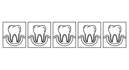 A series of five line drawings depict a tooth and its surrounding bone structure © grvect02