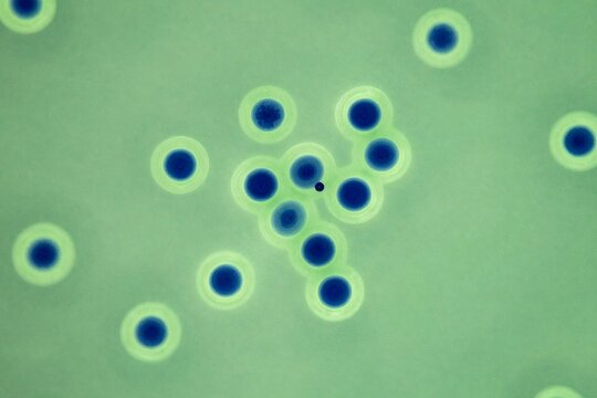 Microscopic view of several yeast cells showing budding process on a light green background