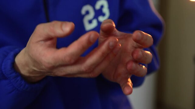 Close up of trembling hands, human health problem concept