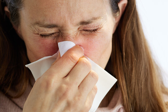 Close-up of a woman with flushed cheeks and closed eyes blowing her nose into a white tissue, depicting physical discomfort from cold, flu, or seasonal allergy symptoms.