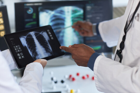 Doctors reviewing chest x ray on tablet and comparing lung scan on monitor, discussing diagnosis and treatment planning. Ideal for healthcare technology, radiology, telemedicine marketing