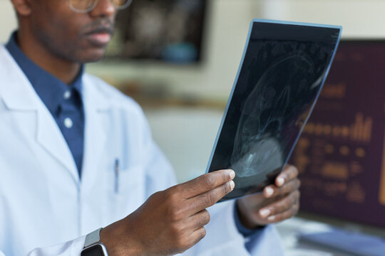 African American male doctor examining mammogram scan in clinic, reviewing diagnostic imaging for breast cancer screening. Ideal for healthcare marketing, radiology services, prevention campaigns