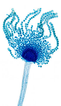 Fungal Conidiophore and Conidia &ndash; Aspergillus Penicillium Morphology, Microbial Imaging