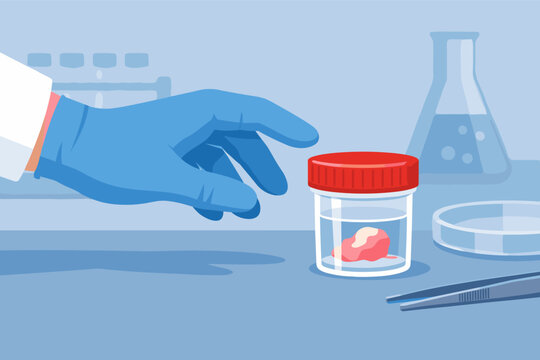 Medical laboratory vector illustration of a gloved hand reaching for a sterile container with a tissue biopsy sample, including laboratory equipment like a flask, petri dish, and tweezers.