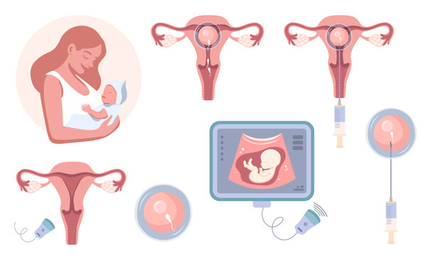 Medical infographic on pregnancy and fertilization. IVF, conception, gynecology, ultrasound. Vector illustration
