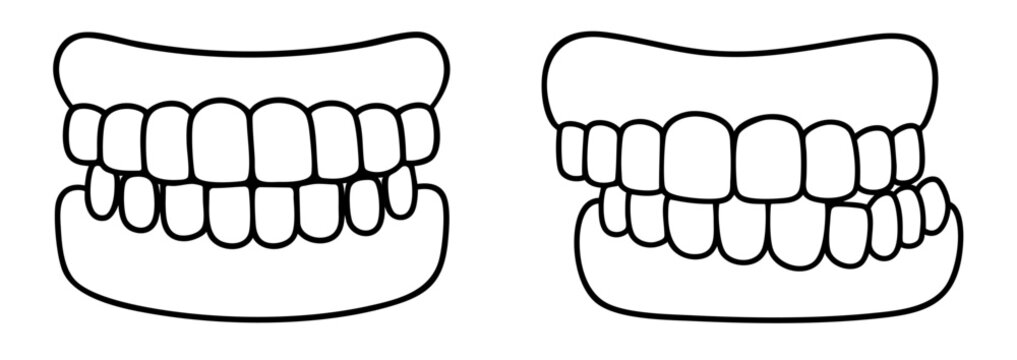 Correct and incorrect bite teeth alignment dental occlusion jaw movement malocclusion orthodontic problem uneven contact of teeth dental comparison line icon
