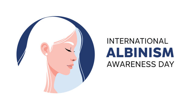 Profile portrait of a beautiful woman with white hair and skin for international albinism awareness day on blue background.