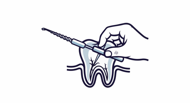 Stylized illustration of a dental drill working on a tooth's root canal