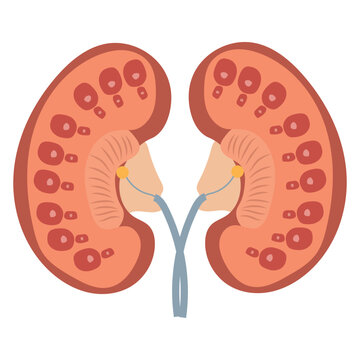 Polycystic kidney disease vector