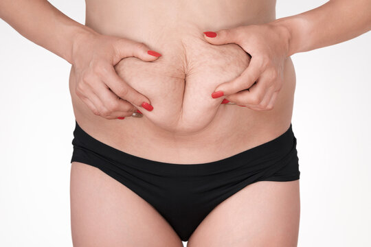 Closeup of woman's hands with red nails pinching excess skin and fat on her stomach. Body image concept showing belly, stretch marks and cellulite. Studio shot on white background