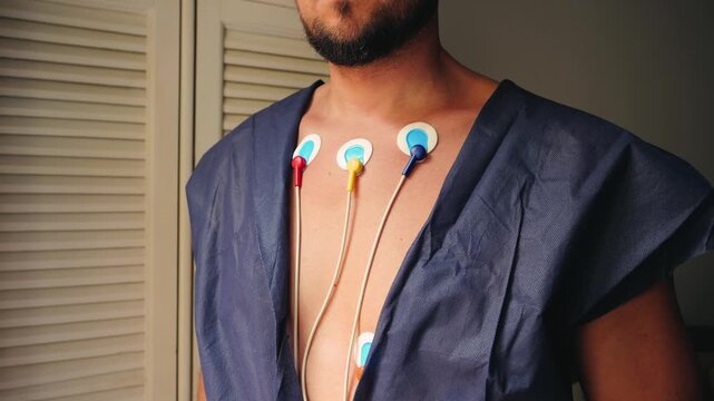 Electrodes of Holter monitor on the body, a portable device that continuously records the heart's electrical activity, electrocardiogram, for 24 hours.