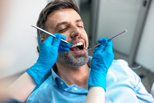 Close up of man during dental procedure with doctor hands in gloves. Stomatology examination using tools and mirror in clinic. Professional teeth care, oral hygiene and healthcare intervention.