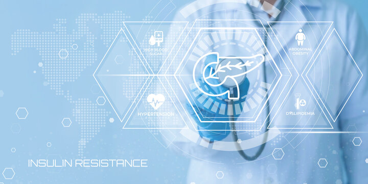 Medical expert wearing blue gloves holding a stethoscope over a digital interface displaying the pancreas symbol and related health icons representing insulin resistance