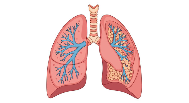 Detailed illustration of the human respiratory system showing lungs, bronchi, and trachea on a white background