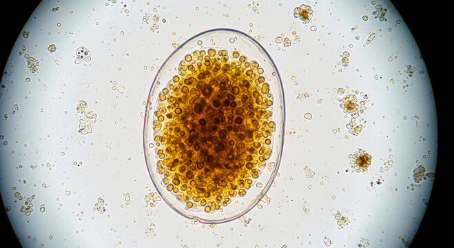 Microscopic view of a parasitic worm egg with granular contents and cellular debris