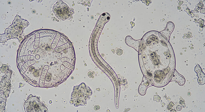 Microscopic view of rotifer and diatom with debris in water plankton organism