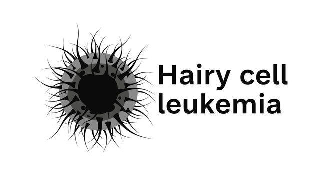 Hairy cell leukemia (HCL) medical illustration showing a stylized lymphocyte with fine, hair-like cytoplasmic projections.