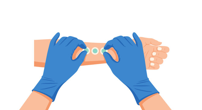 Two hands wearing blue protective surgical gloves carefully place small circular green diagnostic patches onto a light-skinned forearm for medical skin testing.