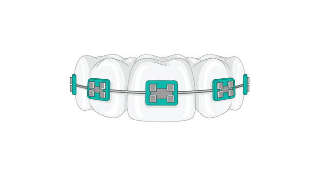 A row of pristine white human teeth features meticulously attached teal orthodontic brackets and silver wires against a clean and minimalist white background.