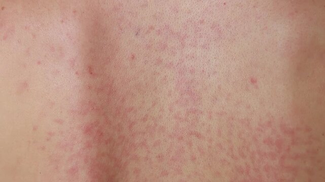 Skin condition shows redness and spots in a close-up view, possibly indicating irritation or rash from an allergic reaction or skin issue.