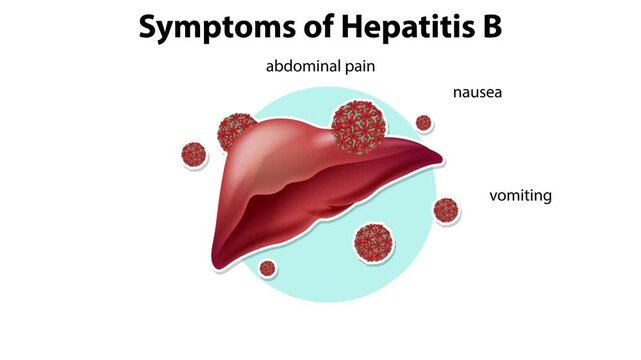 Symptoms of hepatitis b medical infographic animation showing liver inflammation with viral pathogens and list of health signs.