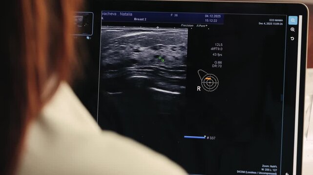 A doctor reviews a mammogram image on a computer screen in office, as part of a breast cancer screening process.