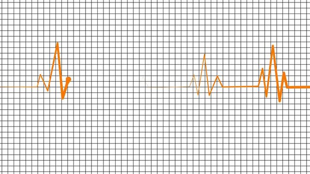 Stylized heartbeat line wave signal animation on graph paper