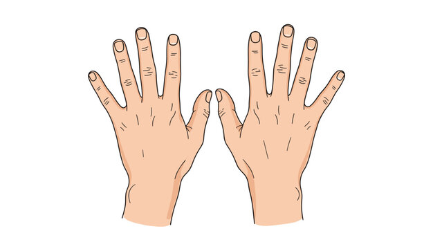 Anatomical illustration of two human hands with palms facing forward showing skin texture and fingernail details on a white background.