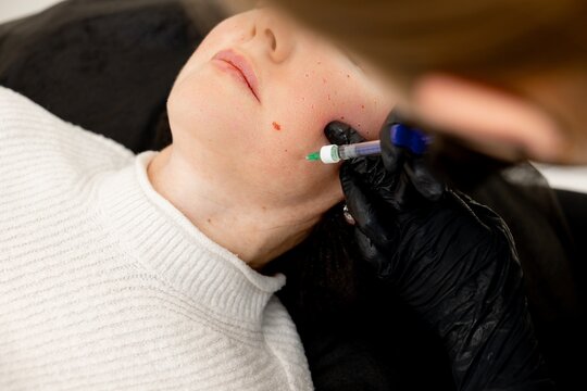 A cosmetologist makes facial mesotherapy injections to a woman. Facial mesotherapy to rejuvenate the skin and improve its health and appearance