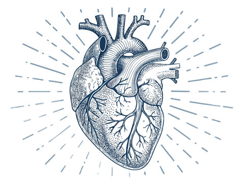 Anatomical illustration of the human heart with a pacemaker lead visible