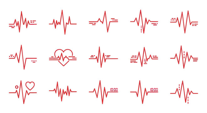 Collection of various ECG heartbeat tracings.