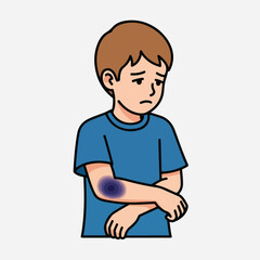 Obraz premium A sad young boy wearing a blue shirt looking down at a large bruise on his arm